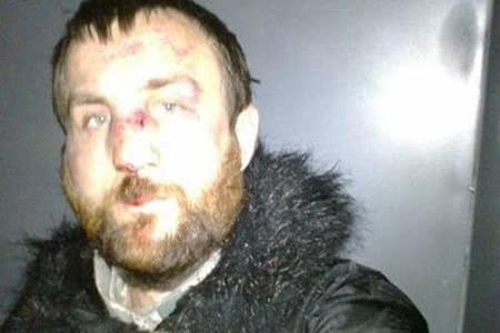Свідкові у справі побиття фотографа Гавриліва погрожують